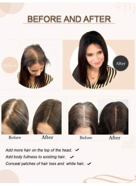 12inch Hair Toppers For Women Real Human Hair Topper Straight Hair Toppers For W